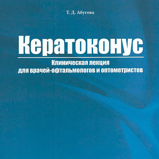 Книга "Кератоконус" для специалистов