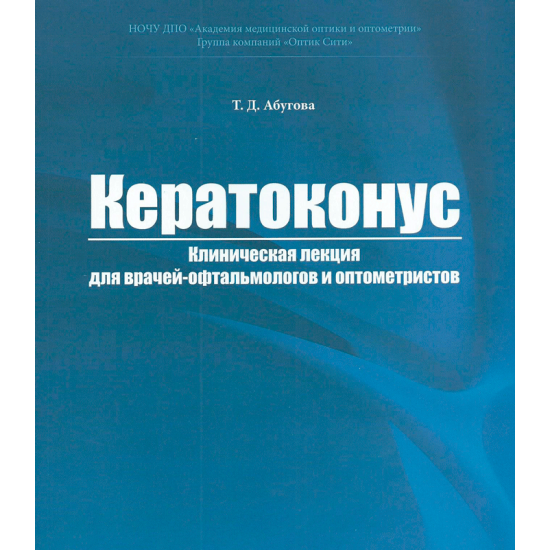 Кератоконус: симптомы, диагностика, лечение