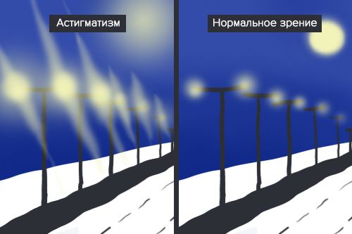 Как выглядят астигматизм и нормальное зрение