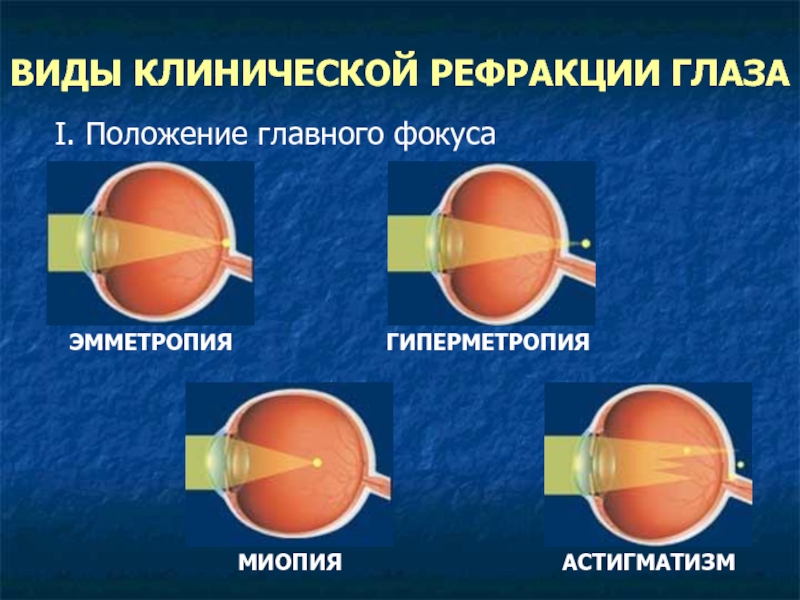 Виды клинической рефрации глаза
