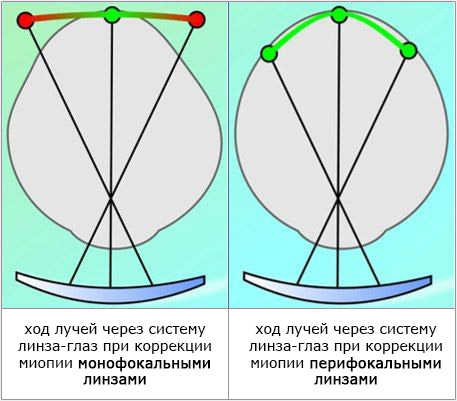 Ход лучей через систему линза-глаз
