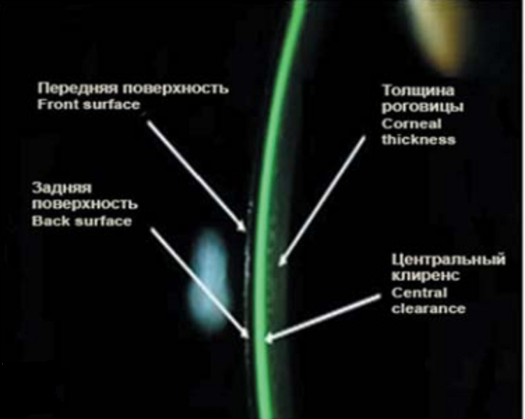 Оптический срез при биомикроскопии